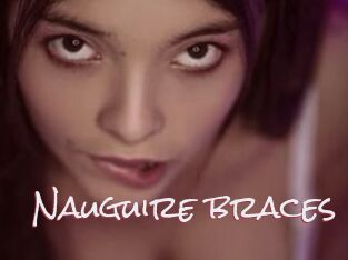 Nauguire_braces